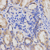 Immunohistochemistry of paraffin-embedded human kidney using AP2A2 antibody at dilution of 1:200 (x400 lens)