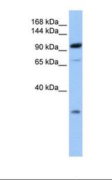 Fetal brain lysate. Antibody concentration: 1.0 ug/ml. Gel concentration: 6-18%.