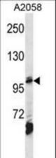 AP2B1 Antibody western blot of A2058 cell line lysates (35 ug/lane). The AP2B1 antibody detected the AP2B1 protein (arrow).