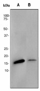 Western blot analysis on (A) fetal brain and (B) HeLa cell lysates using anti-AP2S1 antibody (LS-C105595).