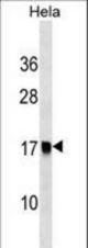 AP2S1 Antibody western blot of HeLa cell line lysates (35 ug/lane). The AP2S1 antibody detected the AP2S1 protein (arrow).