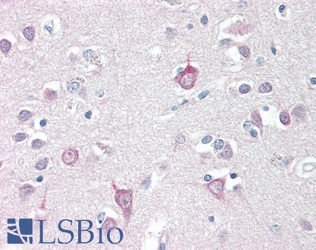 Anti-AP3B2 antibody IHC staining of human brain, cortex. Immunohistochemistry of formalin-fixed, paraffin-embedded tissue after heat-induced antigen retrieval.