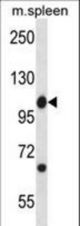 Mouse Abl1 Antibody western blot of mouse spleen tissue lysates (35 ug/lane). The Abl1 antibody detected the Abl1 protein (arrow).