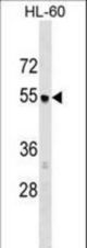 AP3M1 Antibody western blot of HL-60 cell line lysates (35 ug/lane). The AP3M1 antibody detected the AP3M1 protein (arrow).