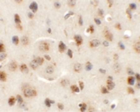 Immunohistochemistry of AP3M1 in mouse brain tissue with AP3M1 antibody at 5 ug/ml.