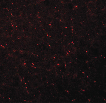 Immunofluorescence of AP3M1 in mouse brain tissue with AP3M1 antibody at 20 ug/ml.