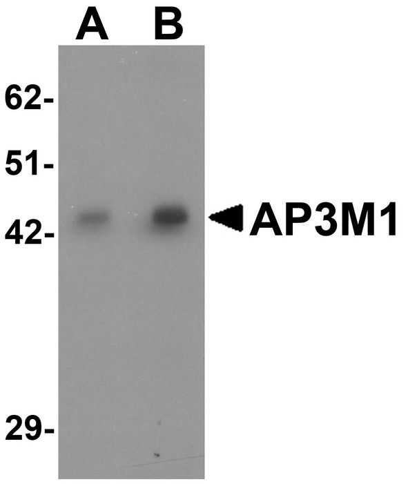Western blot analysis of AP3M1 in human brain tissue lysate with AP3M1 antibody at (A) 1 and (B) 2 ug/ml .