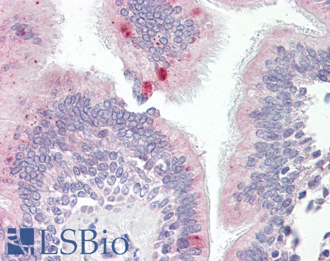 Anti-AP3M1 antibody IHC of human lung, respiratory epithelium. Immunohistochemistry of formalin-fixed, paraffin-embedded tissue after heat-induced antigen retrieval. Antibody LS-B8008 dilution 10 ug/ml.