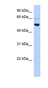 AP3M2 antibody LS-C102417 Western blot of HepG2 cell lysate.