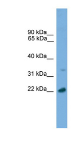 AP3S1 / CLAPS3 antibody LS-C117126 Western blot of 293T cell lysate.