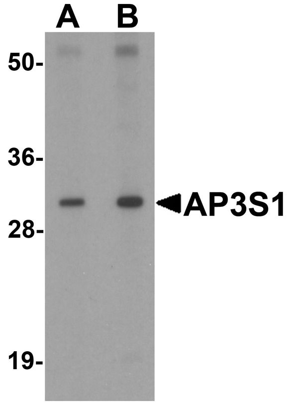 Western blot analysis of AP3S1 in mouse kidney tissue lysate with AP3S1 antibody at (A) 1 and (B) 2 ug/ml .