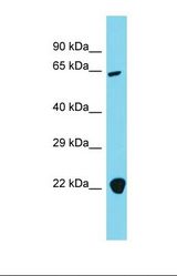Western blot of Human 293T. AP4B1 antibody dilution 1.0 ug/ml.