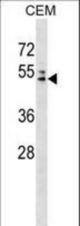 AP4M1 Antibody western blot of CEM cell line lysates (35 ug/lane). The AP4M1 antibody detected the AP4M1 protein (arrow).