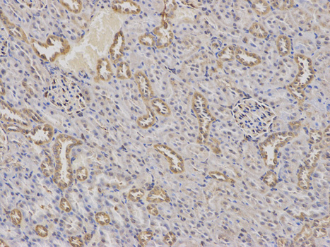 Immunohistochemistry of paraffin-embedded rat kidney using AP2M1 antibody at dilution of 1:100 (200x lens).