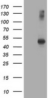 HEK293T cells were transfected with the pCMV6-ENTRY control (Left lane) or pCMV6-ENTRY AP2M1 (Right lane) cDNA for 48 hrs and lysed. Equivalent amounts of cell lysates (5 ug per lane) were separated by SDS-PAGE and immunoblotted with anti-AP2M1.