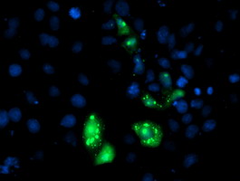 Anti-AP2M1 mouse monoclonal antibody immunofluorescent staining of COS7 cells transiently transfected by pCMV6-ENTRY AP2M1.