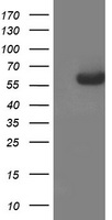 HEK293T cells were transfected with the pCMV6-ENTRY control (Left lane) or pCMV6-ENTRY AP2M1 (Right lane) cDNA for 48 hrs and lysed. Equivalent amounts of cell lysates (5 ug per lane) were separated by SDS-PAGE and immunoblotted with anti-AP2M1.