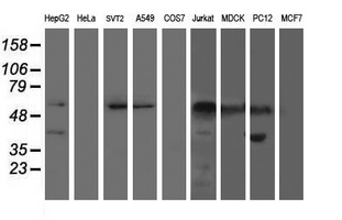 Western blot of extracts (35ug) from 9 different cell lines by using anti-AP2M1 monoclonal antibody.