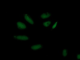 Immunofluorescent staining of HeLa cells using anti-AP2M1 mouse monoclonal antibody.