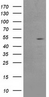 HEK293T cells were transfected with the pCMV6-ENTRY control (Left lane) or pCMV6-ENTRY AP2M1 (Right lane) cDNA for 48 hrs and lysed. Equivalent amounts of cell lysates (5 ug per lane) were separated by SDS-PAGE and immunoblotted with anti-AP2M1.