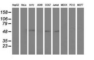 Western blot of extracts (35ug) from 9 different cell lines by using anti-AP2M1 monoclonal antibody.