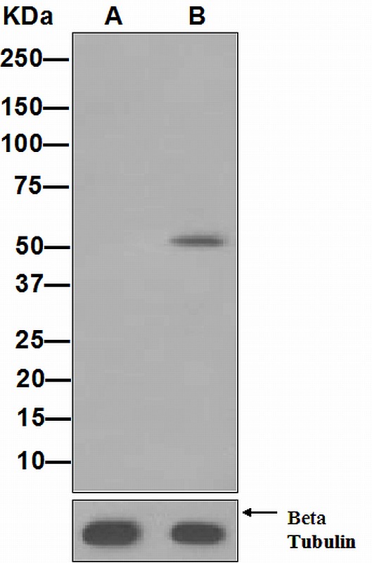 Western blot analysis on 293T cell lysates using anti-Phospho-AP2 mu1 (pT156) antibody. Cells were either (A) untreated (B) treated with Calyculin A.