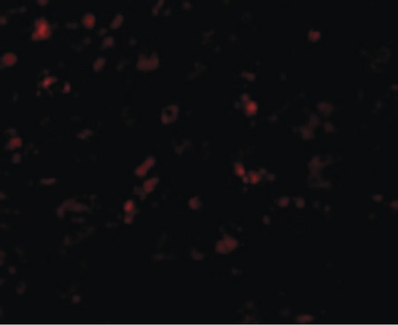 Immunofluorescence of AP2M1 in Mouse Kidney cells with AP2M1 antibody at 20 ug/ml.