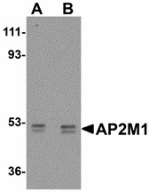 Western blot of AP2M1 in human kidney tissue lysate with AP2M1 antibody at (A) 1 and (B) 2 ug/ml. Below: Immunohistochemistry of AP2M1 in mouse kidney tissue with AP2M1 antibody at 2.5 ug/ml.