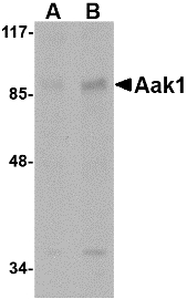 Western blot of Aak1 in A-20 lysate with Aak1 antibody at (A) 1 and (B) 2 ug/ml.