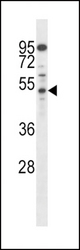 AP2M1 Antibody western blot of mouse Neuro-2a cell line lysates (35 ug/lane). The AP2M1 antibody detected the AP2M1 protein (arrow).