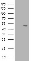 HEK293T cells were transfected with the pCMV6-ENTRY control (Left lane) or pCMV6-ENTRY AP2M1 (Right lane) cDNA for 48 hrs and lysed. Equivalent amounts of cell lysates (5 ug per lane) were separated by SDS-PAGE and immunoblotted with anti-AP2M1.