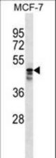 MUDEN Antibody western blot of MCF-7 cell line lysates (35 ug/lane). The MUDEN antibody detected the MUDEN protein (arrow).