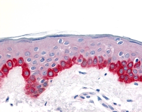 Immunohistochemistry of Apaf1 in human skin tissue with Apaf1 antibody at 20 µg/ml.