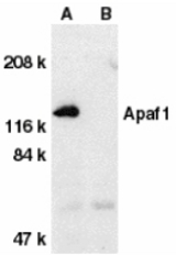 Western blot of Apaf1 in human heart tissue lysate with Apaf1 antibody at 1 ug/ml dilution in the absence (A) or presence (B) of blocking peptide.