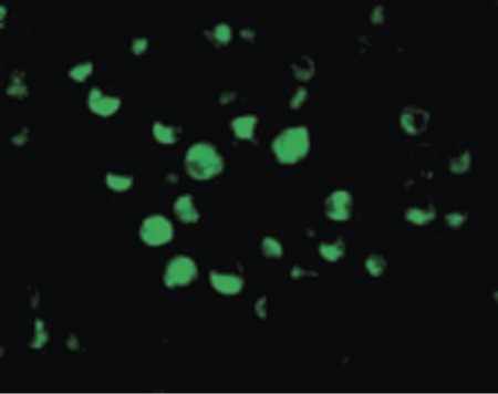 Immunofluorescence of Apaf1 in K562 cells with Apaf1 antibody at 10 ug/ml.