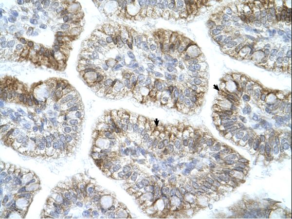 APBA1 antibody LS-C40544 was used in IHC to stain formalin-fixed, paraffin-embedded human intestine.