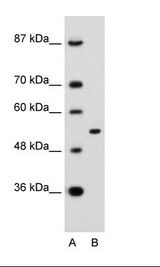 A: Marker, B: Rap Cell Lysate