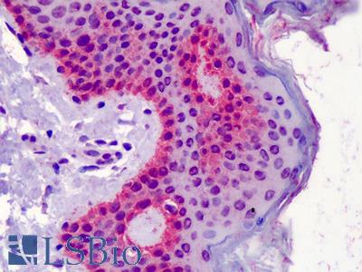 Anti-UROP11 antibody IHC of human skin. Immunohistochemistry of formalin-fixed, paraffin-embedded tissue after heat-induced antigen retrieval. Antibody LS-B4979 concentration 5 ug/ml.