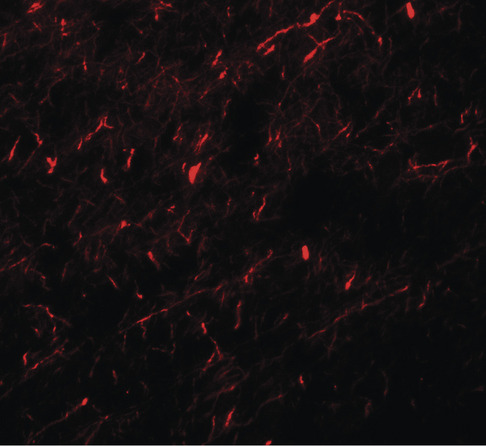 Immunofluorescence of APBA1 in human brain tissue with APBA1 antibody at 20 ug/ml.