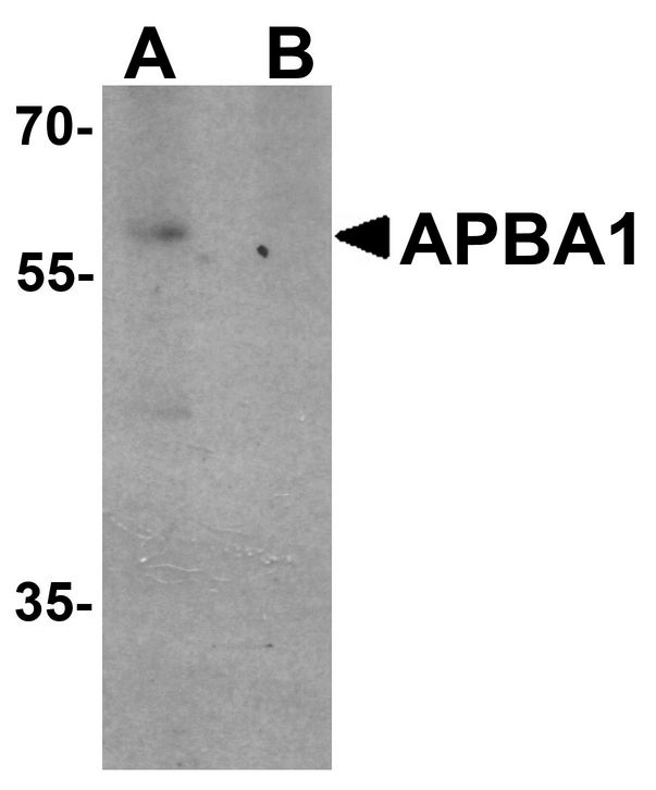 Western blot analysis of APBA1 in rat brain tissue lysate with APBA1 antibody at 0.5 ug/ml in (A) the absence and (B) the presence of blocking peptide.