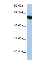 APBA3 antibody LS-C102837 Western blot of HepG2 Cell lysate. Antibody concentration 1 ug/ml.
