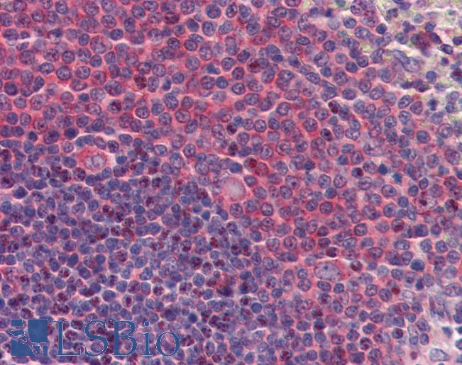 Anti-AAK1 antibody IHC of human spleen. Immunohistochemistry of formalin-fixed, paraffin-embedded tissue after heat-induced antigen retrieval. Antibody LS-B3843 concentration 5 ug/ml.