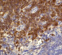 IHC of paraffin-embedded human tonsils using anti-RIAM antibody (LS-C105415).