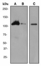 Western blot analysis on (A) HL-60 + Retinoic acid (B) HL-60 cell lysates and (C) Human thymus lysate using anti-RIAM antibody (LS-C105415), dilution 1:2000.