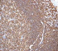 IHC of paraffin-embedded human tonsil tissue using anti-RIAM antibody.