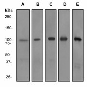 Western blot analysis on (A) Human Lymph node (B) Fetal brain (C) human spleen (D) Jurkat and (E) HL-60 + retinoic acid cell lysates using anti-RIAM antibody (LS-C105637).