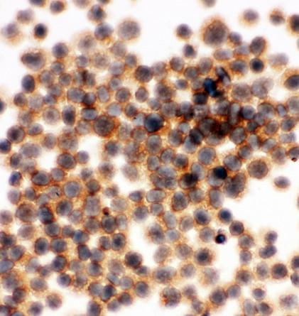 APBB1IP / RIAM antibody. ICC: JURKAT Cell.