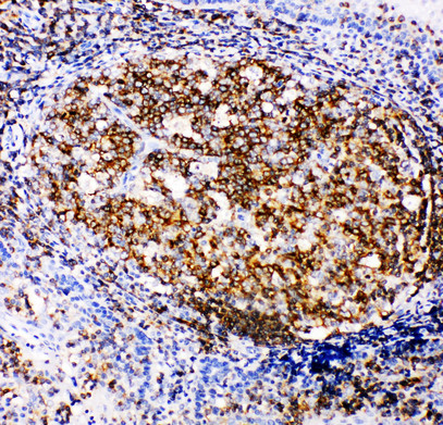 APBB1IP / RIAM antibody. IHC(P): Human Tonsil Tissue.