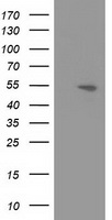 HEK293T cells were transfected with the pCMV6-ENTRY control (Left lane) or pCMV6-ENTRY APBB3 (Right lane) cDNA for 48 hrs and lysed. Equivalent amounts of cell lysates (5 ug per lane) were separated by SDS-PAGE and immunoblotted with anti-APBB3.