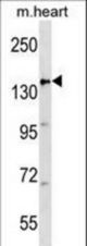 APC Antibody western blot of mouse heart tissue lysates (35 ug/lane). The APC antibody detected the APC protein (arrow).